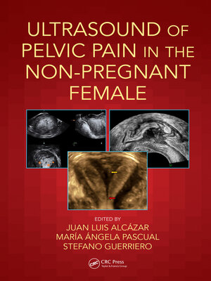 cover image of Ultrasound of Pelvic Pain in the Non-Pregnant Patient